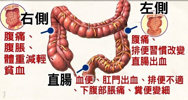 大便不成形一定是肠癌吗?别慌,医生告诉你怎么办