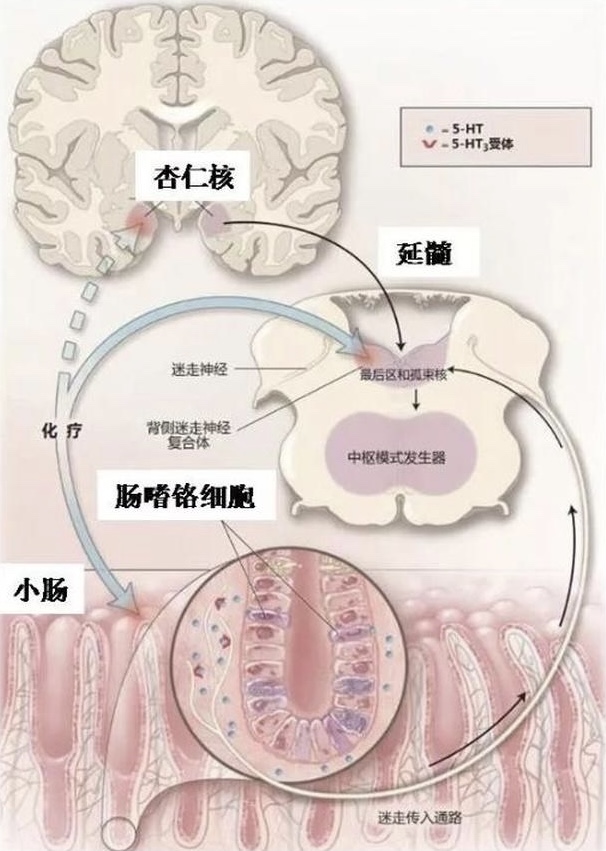 反复呕吐旷课1个月，胃镜结果发现病因，但结果出乎所有人意料