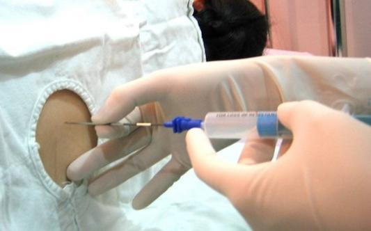 剖腹产拔导尿管后，产妇排尿困难？学会4招，产妇排尿很轻松