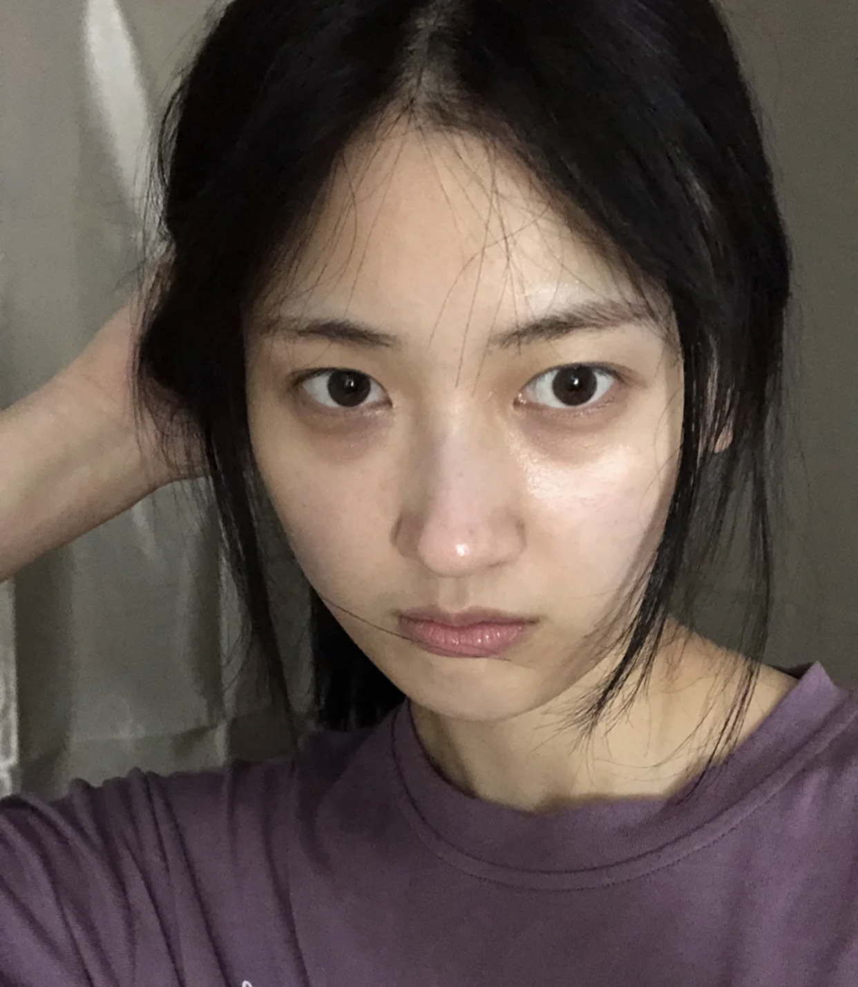 消除黑眼圈的方法有哪些?