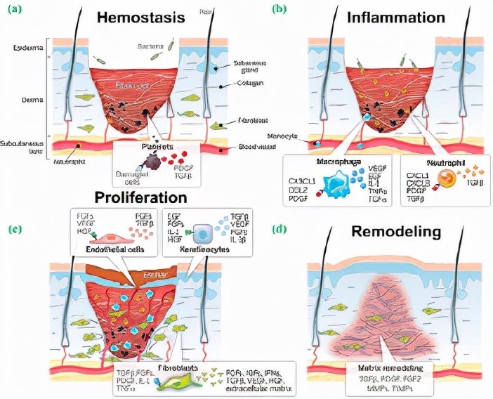 西安交通大学郭保林:功能性水凝胶作为伤口敷料以增强