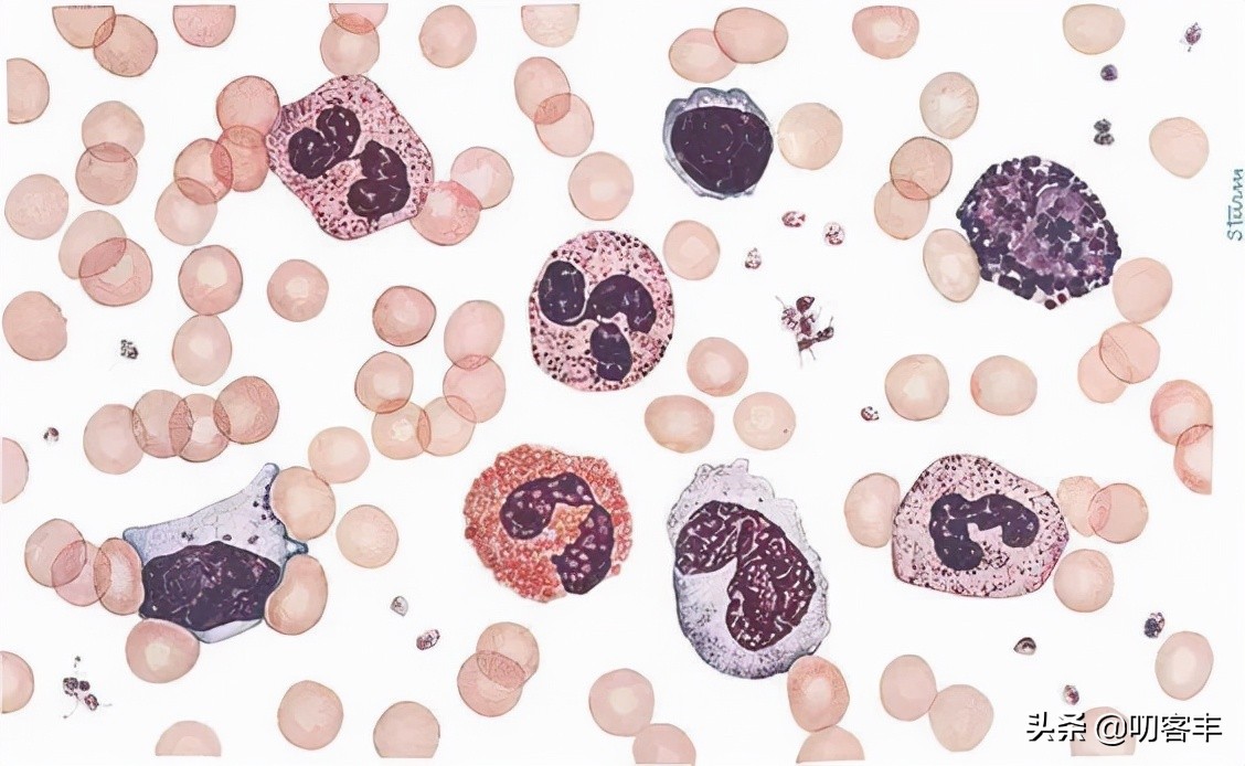 白细胞高就是细菌感染吗?