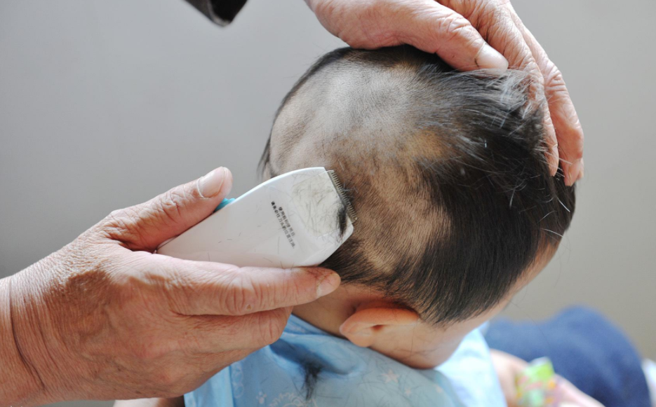 剃胎发需要注意些什么