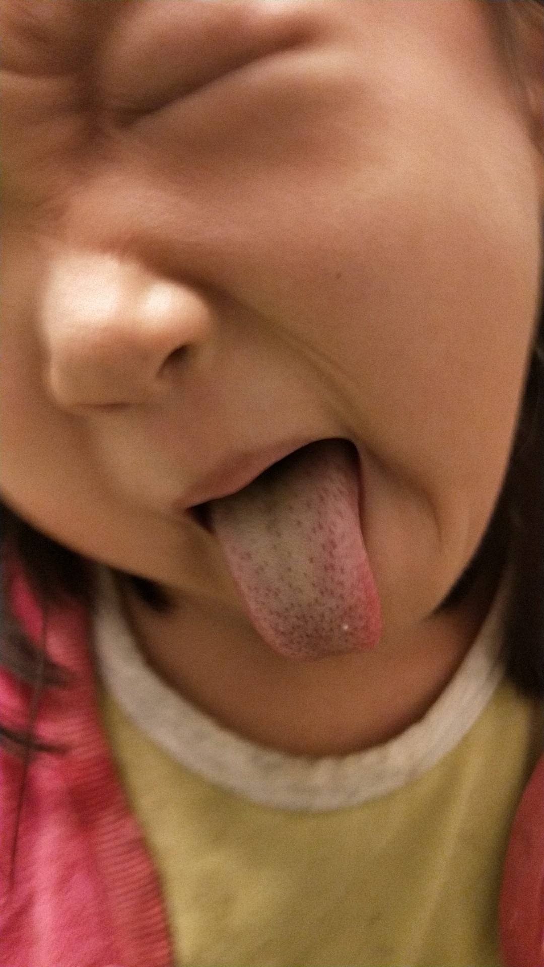 辨别孩子是不是脾虚？中医师教你这几招！调理脾虚重在坚持！