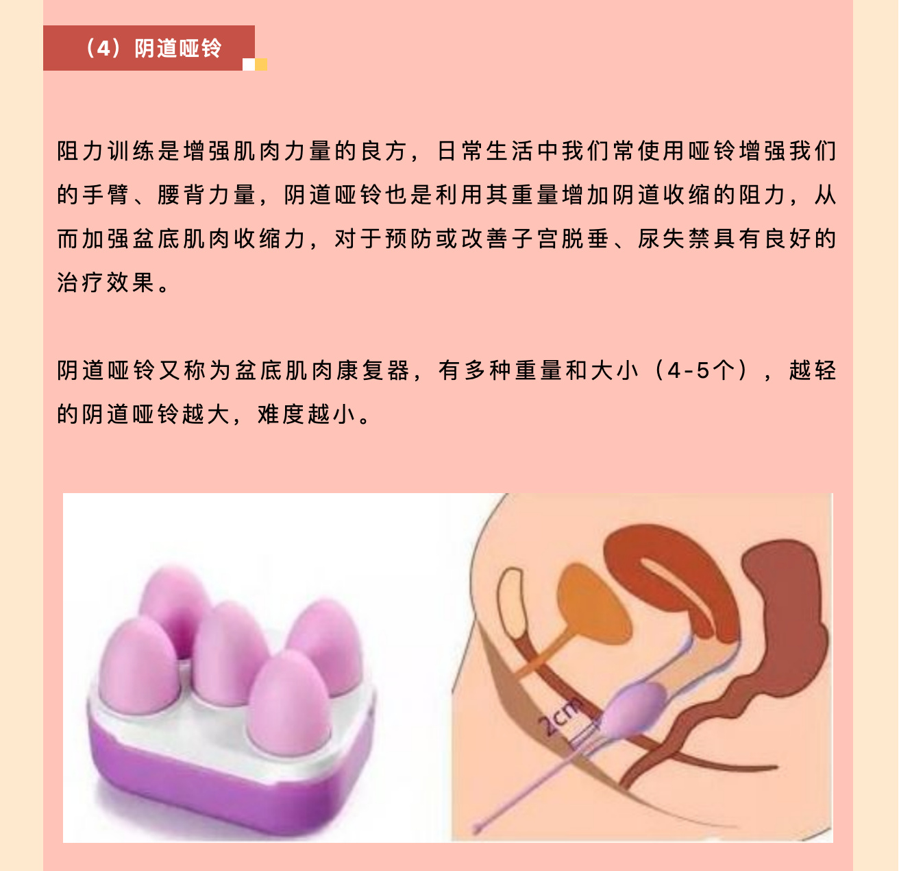 产后小腹总有下坠感，要警惕子宫脱垂啦