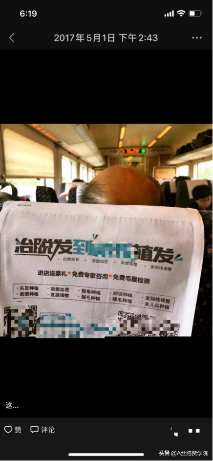 “头等大事”！浅谈医药行业-植发子赛道市场