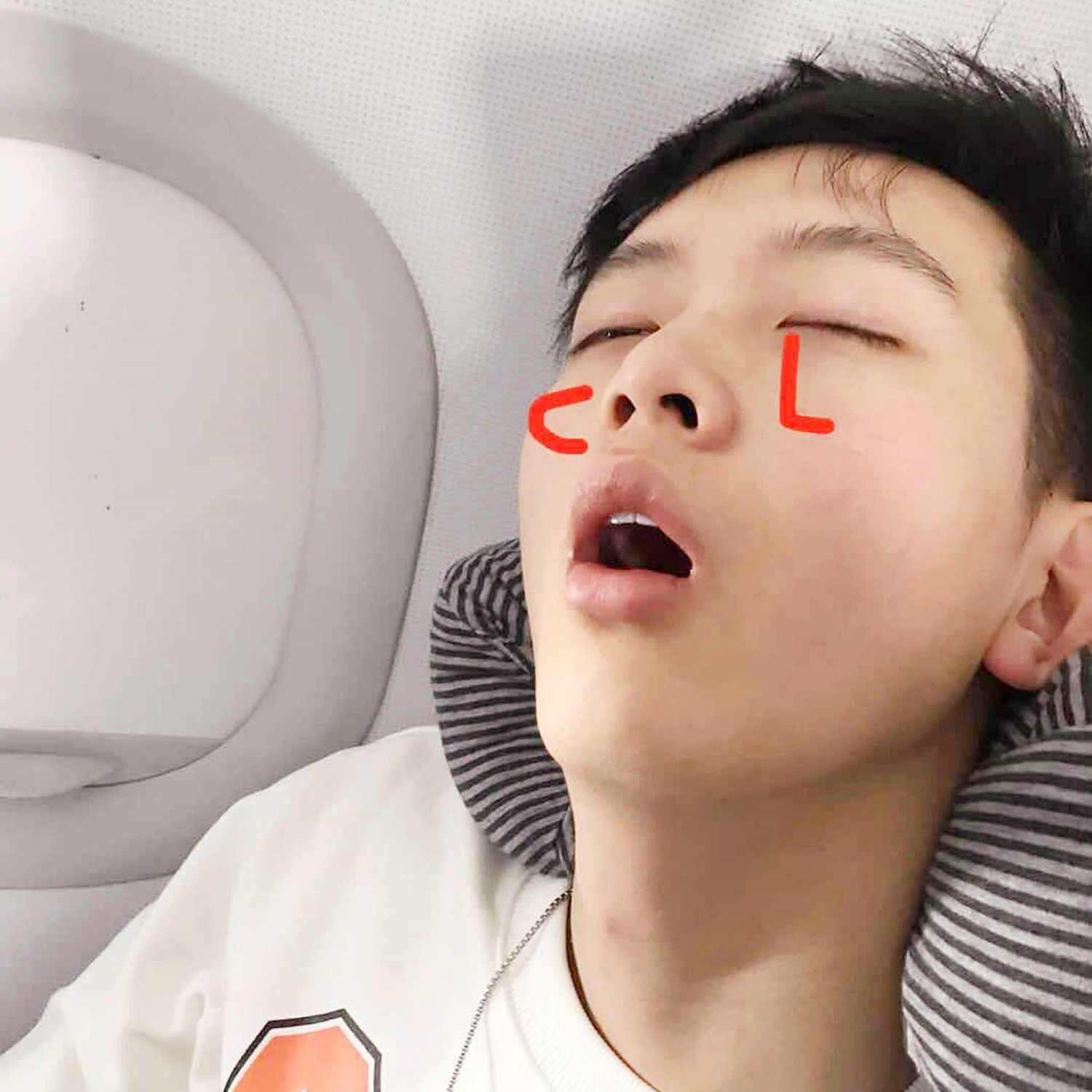 孩子“嘴部”越长越难看，不是环境影响颜值，可能是睡觉的坏习惯