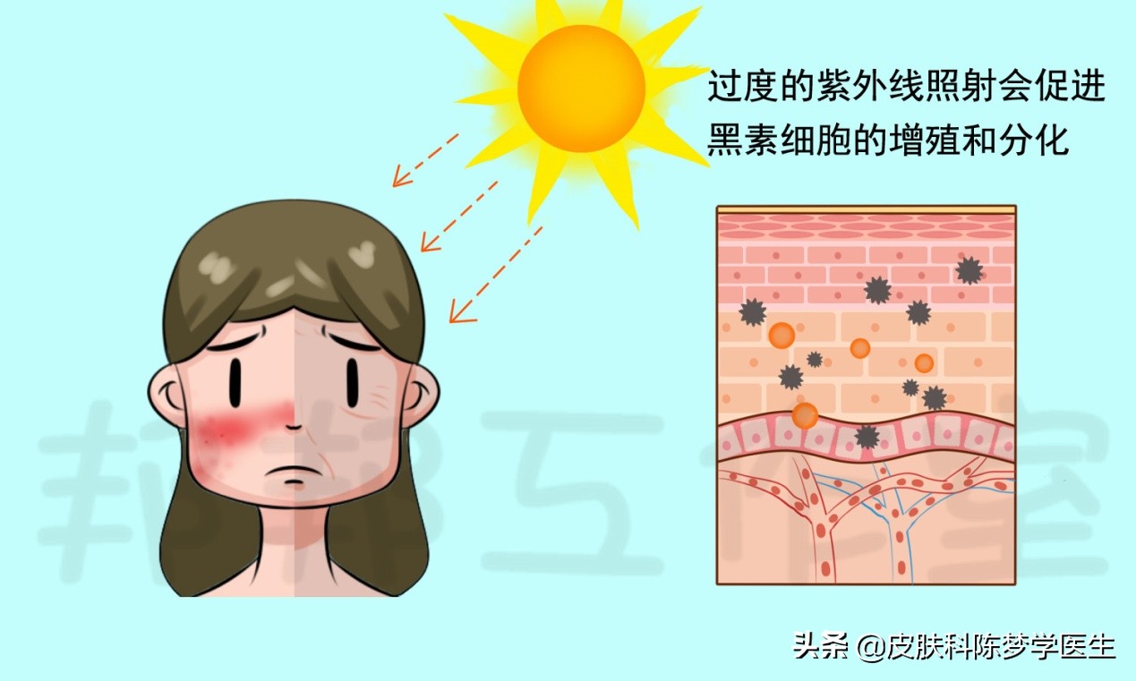 华山医院激光祛斑价格喝酱油皮肤会变黑