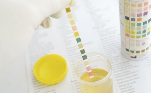 晨起尿液发黄，检查尿胆红素高，是不是肝炎的表现？会影响入职吗