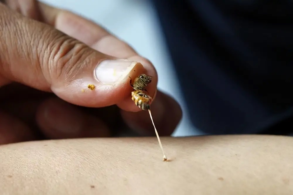 清明扫墓,广西一男子被马蜂蜇死!马蜂到底有多毒?