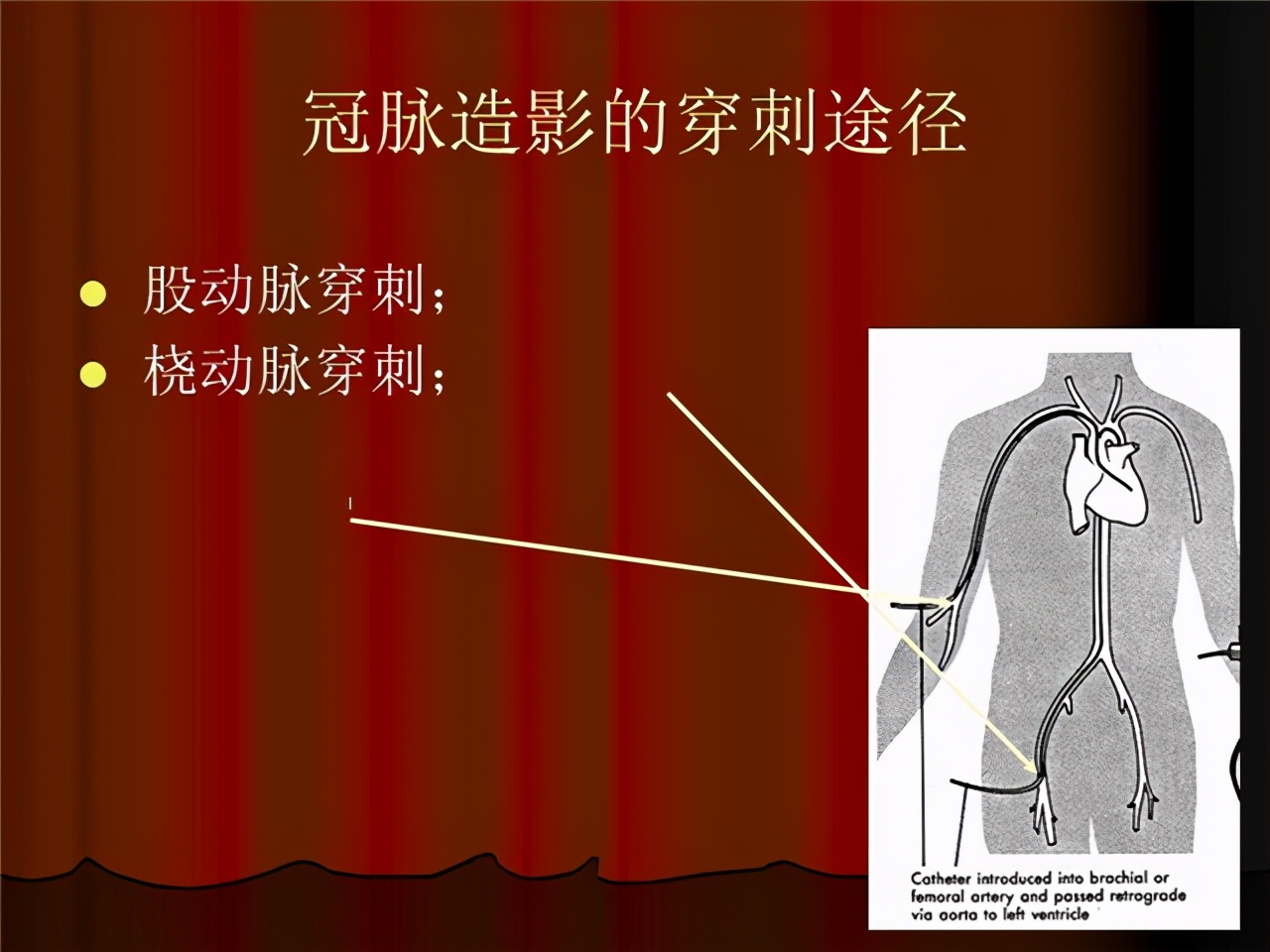 冠脉CT造影检查是怎样做的？对身体会造成什么影响？