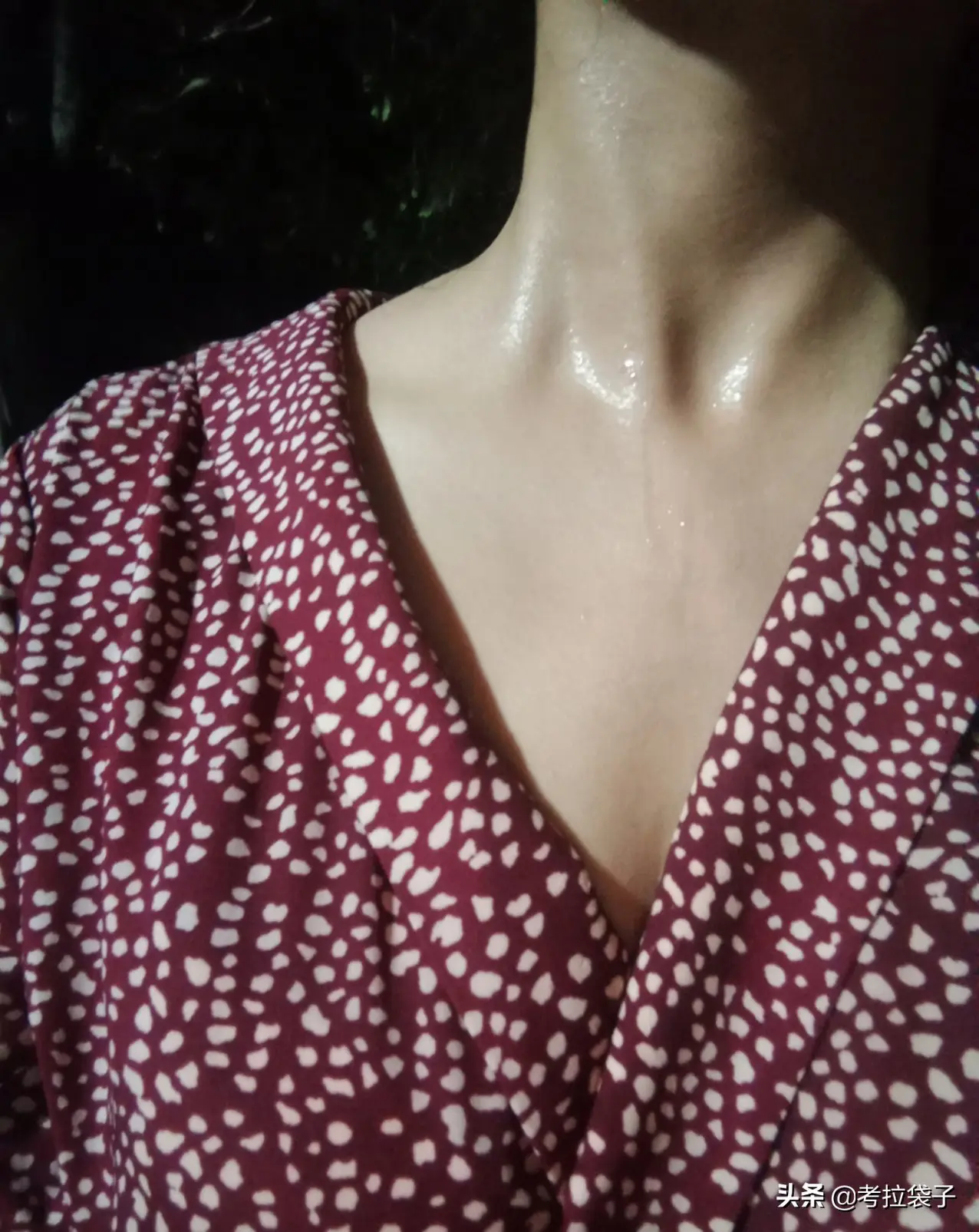 皮肤干燥过敏怎样处理（皮肤干燥过敏用什么护肤品）