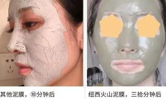 这款被称作“神奇”的泥膜，得到张韶涵力荐：草莓鼻用几次就好了