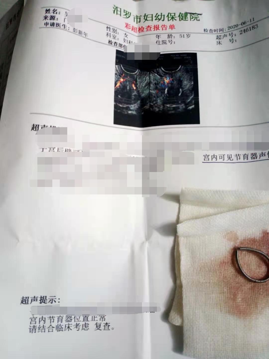 节育环“取出”多年仍怀不上孩子，为看“病”花去数万元，23年后体检发现节育环仍在体内