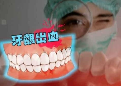 涨知识！牙龈又不痛又没伤口，可是经常出血是什么原因？