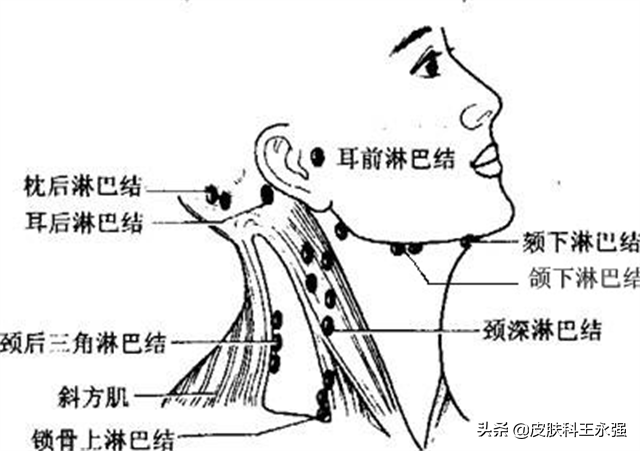 淋巴结出现这几个异常，暗示身体有病？对照看看，以免恶变