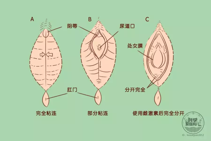 别大意！6大私处问题离娃并不远，护理全看这一篇！