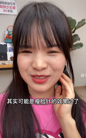 47岁七阿姨承认打瘦脸针！称打瘦脸针会落下后遗症：法令纹加重