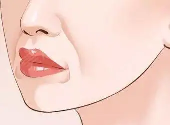 导致面部显老的鼻唇沟是什么，如何改善？