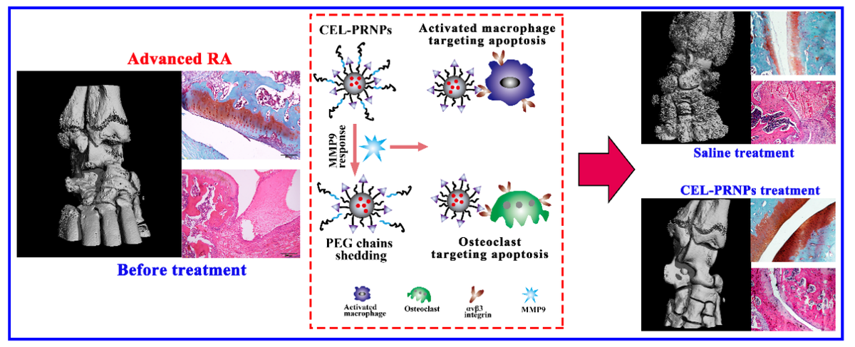 首次证实！全球3.55亿人患这种病，四川科研人员成果公开发表！