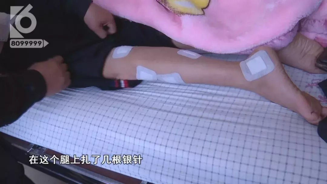 半小时治疗花费近5万 腹部肿瘤只需腿上扎针就能治疗?