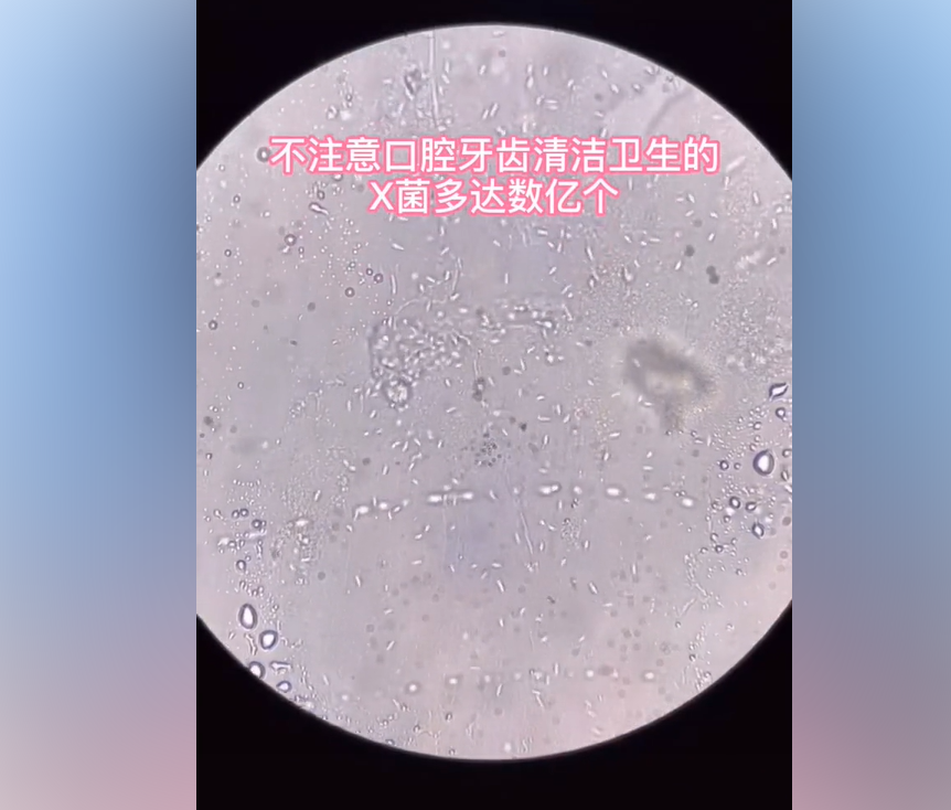显微镜爱好者@微知虎哥取了一颗儿童的蛀牙,放在显微镜之下,放大了