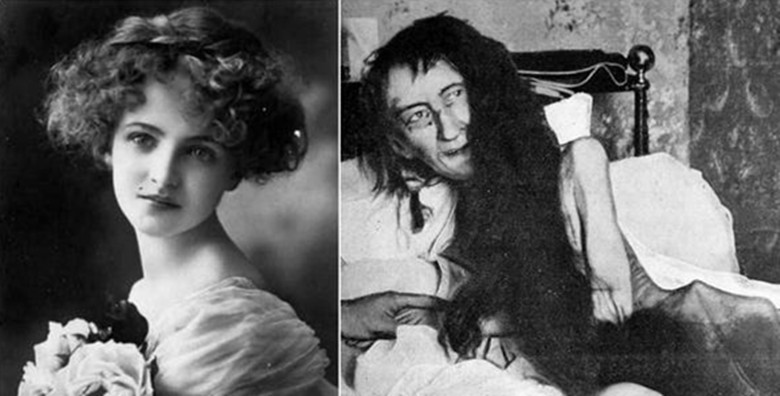 法国贵族少女，被母亲哥哥囚禁25年，获救时睡在自己的排泄物中