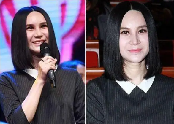 娱乐圈10位被整容毁掉的女星，有人脸僵如石，有的命丧手术台