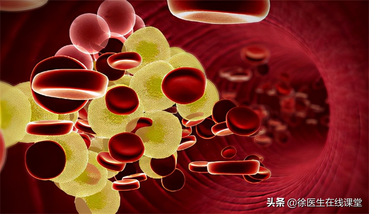 血脂高怎么办？必须吃药吗？别着急，先试试这些办法，降低胆固醇