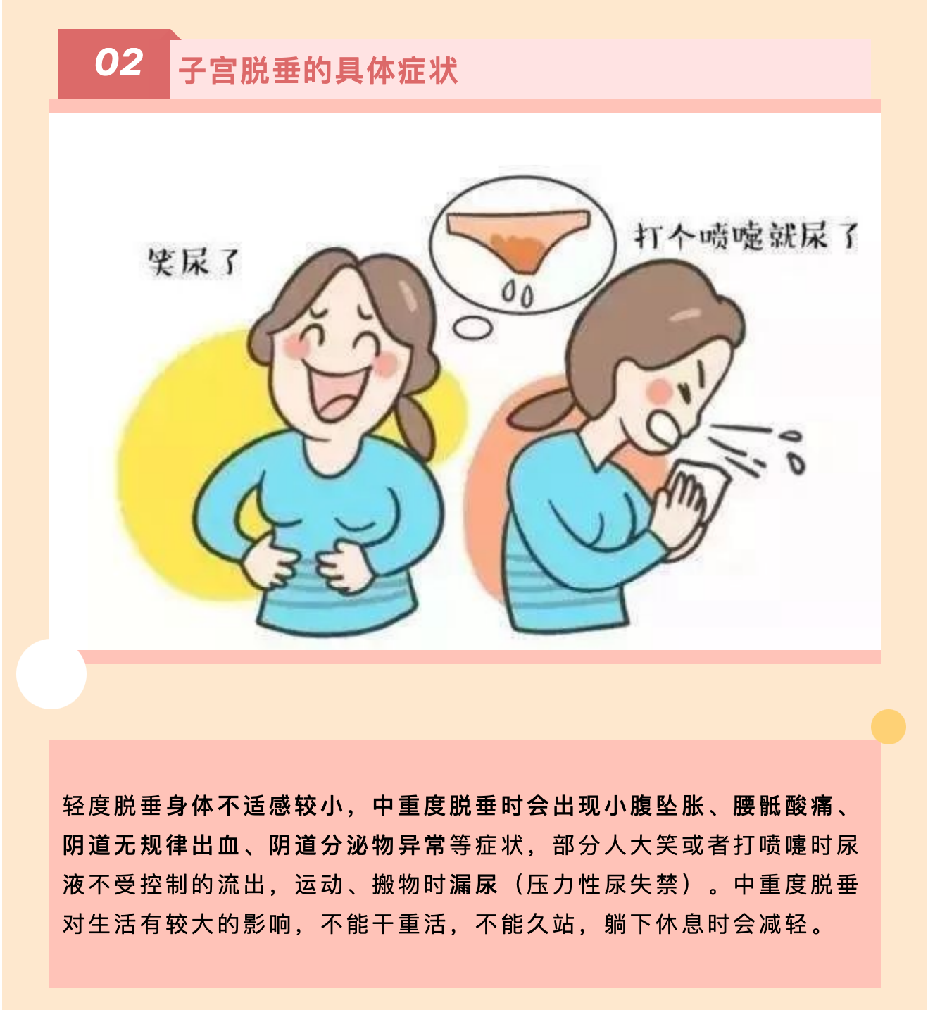 产后小腹总有下坠感，要警惕子宫脱垂啦