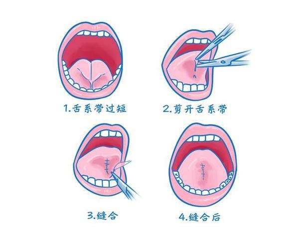 剪舌头动作图片