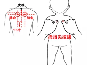 秋季预防宝宝咳嗽小常识，听声音辨疾病！！！