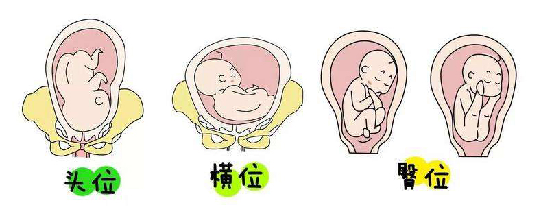 孕晚期胎儿"头朝下"的姿势不难受吗?为和妈妈见面,胎儿很努力