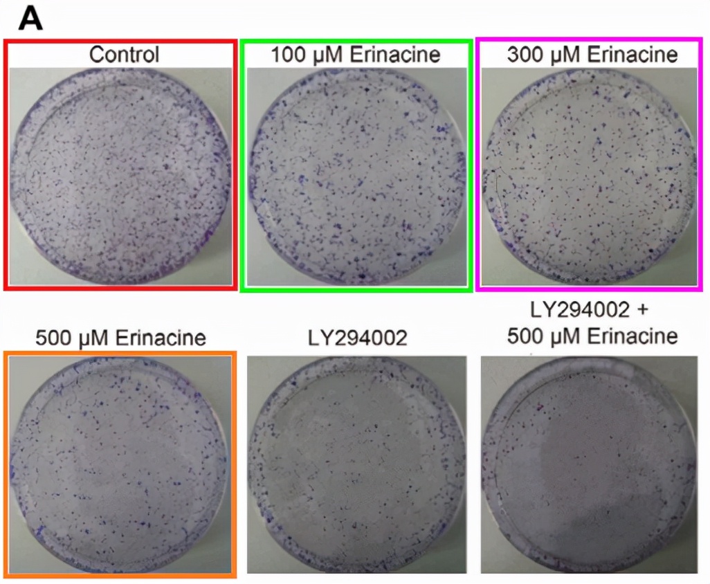 华北理工大学附属医院发表的SCI因图片疑似与他人文章重复遭质疑