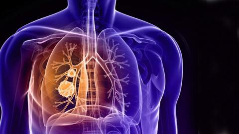容易咳嗽的人，除新冠肺炎之外，还可能是3种疾病造成的