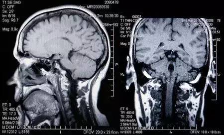 骨科那些“拍片”，你知道该怎么选吗？