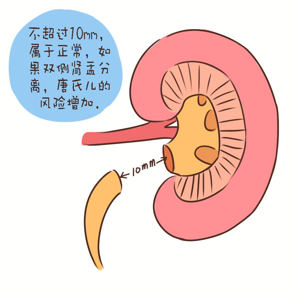 孕期做四维检查，了解这些指标，不用求医生，自己看胎儿是否健康