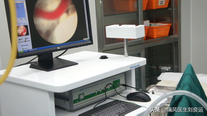 痛风石可以做手术取石吗？如何清除关节处尿酸盐结晶和积液？