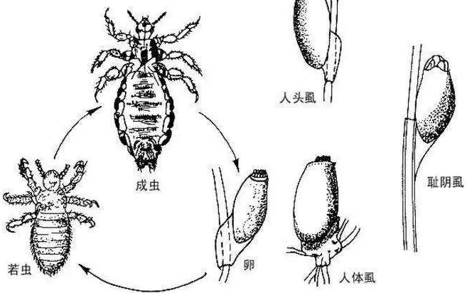 30年前，虮子在男女老少人头上很常见，为啥忽然间消失不见了？