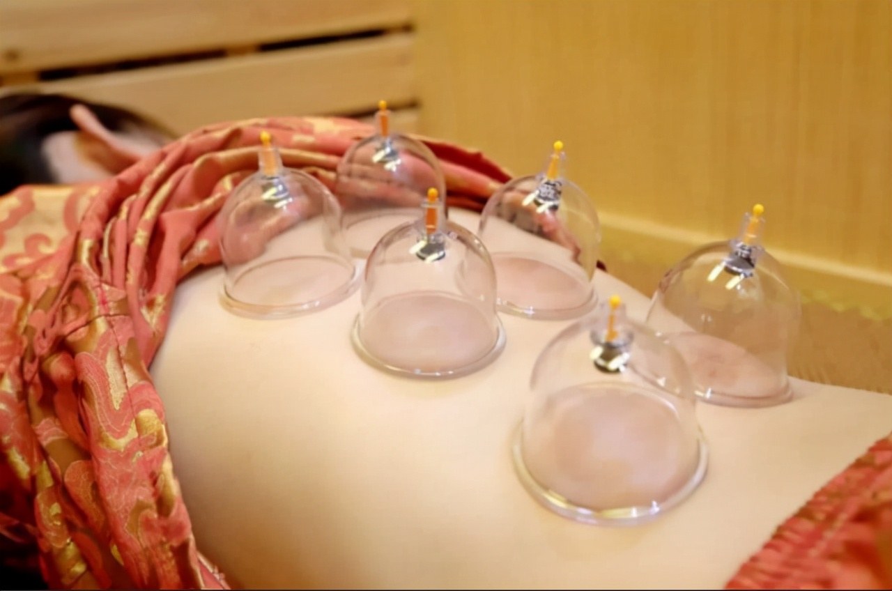 拔罐的好处和坏处(拔血罐的好处和坏处)-情感知识库-动动脑