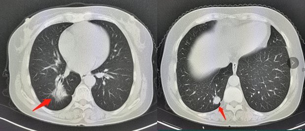 网友：看不起病啦，去个医院就是一堆检查，CT彩超磁共振，贵呀！