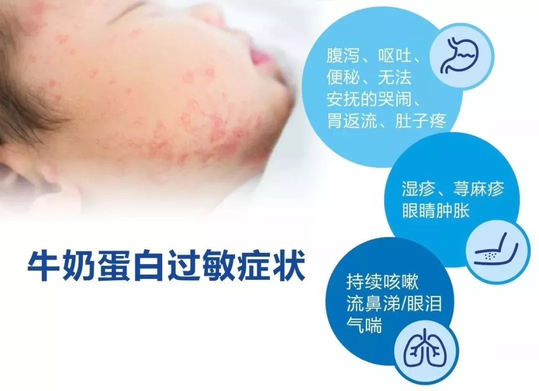 如何判断宝宝腹泻是否由母乳性湿疹引起