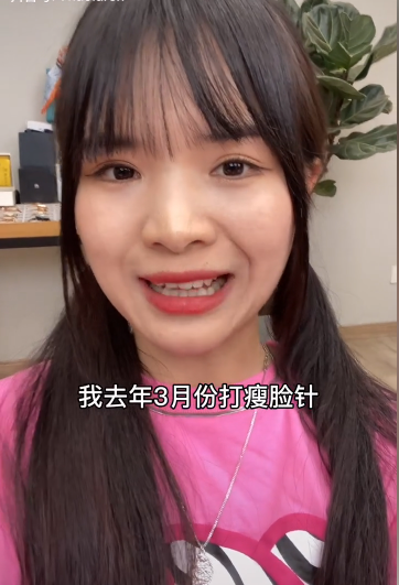 47岁七阿姨承认打瘦脸针！称打瘦脸针会落下后遗症：法令纹加重