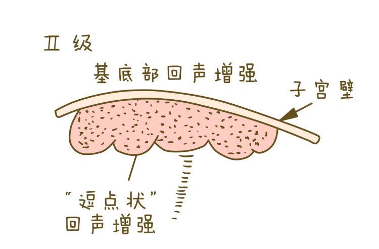 如何判断胎盘成熟度 怎么看胎盘发育得好不好