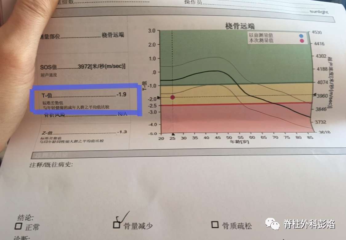 检查这么多做哪个？医生教你不花冤枉钱，一招确定是否骨质疏松