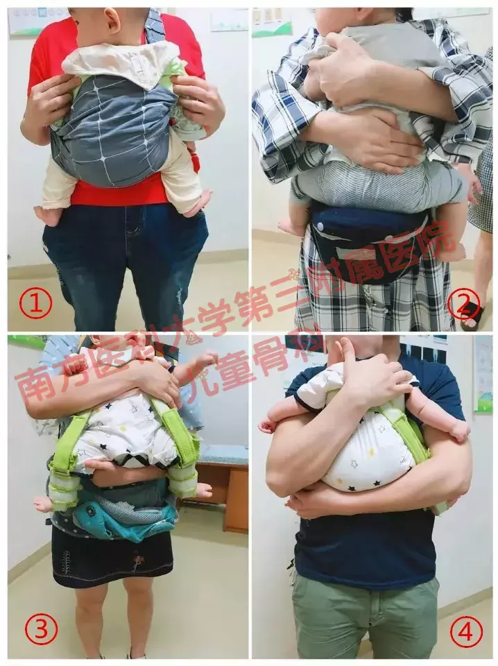 婴儿髋关节不对称图片(宝宝臀纹不对称妈妈不上心) - 赤虎壹号