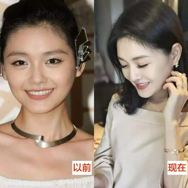 大S一直以来强推的美白针说不清哪里好?但就是每个人都想要?