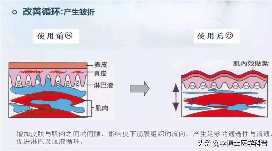 nba打球为什么脚上缠布(NBA火箭队当家球星詹姆斯.哈登为什么喜欢往身上贴“电工胶布”？)