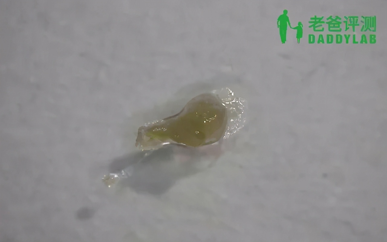 黑头究竟要怎么去？我们拔出并放大了四种类型的黑头