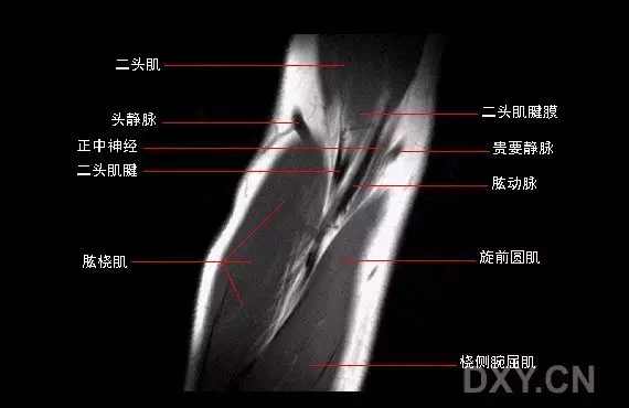 影像解剖:肘關節mri圖譜,超全整理